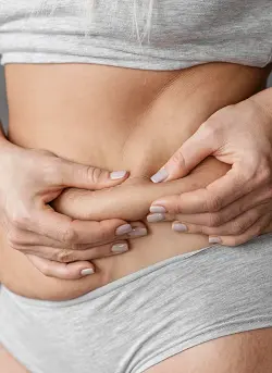 Abdominoplastia5